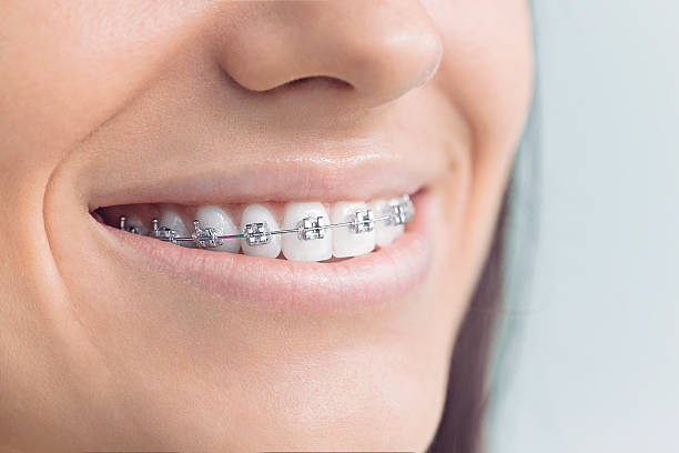 Best Dentures (Full and Partial)  in Mason, MI